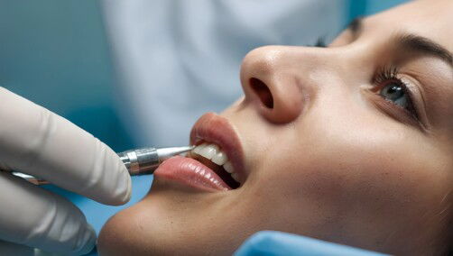 cosmetic dentistry in istanbul