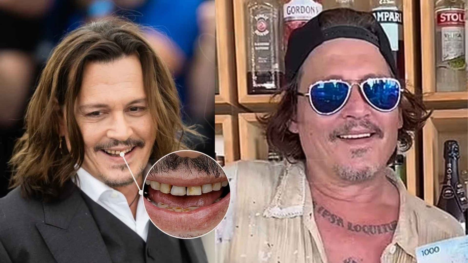 Johnny Depp New Teeth Before And After