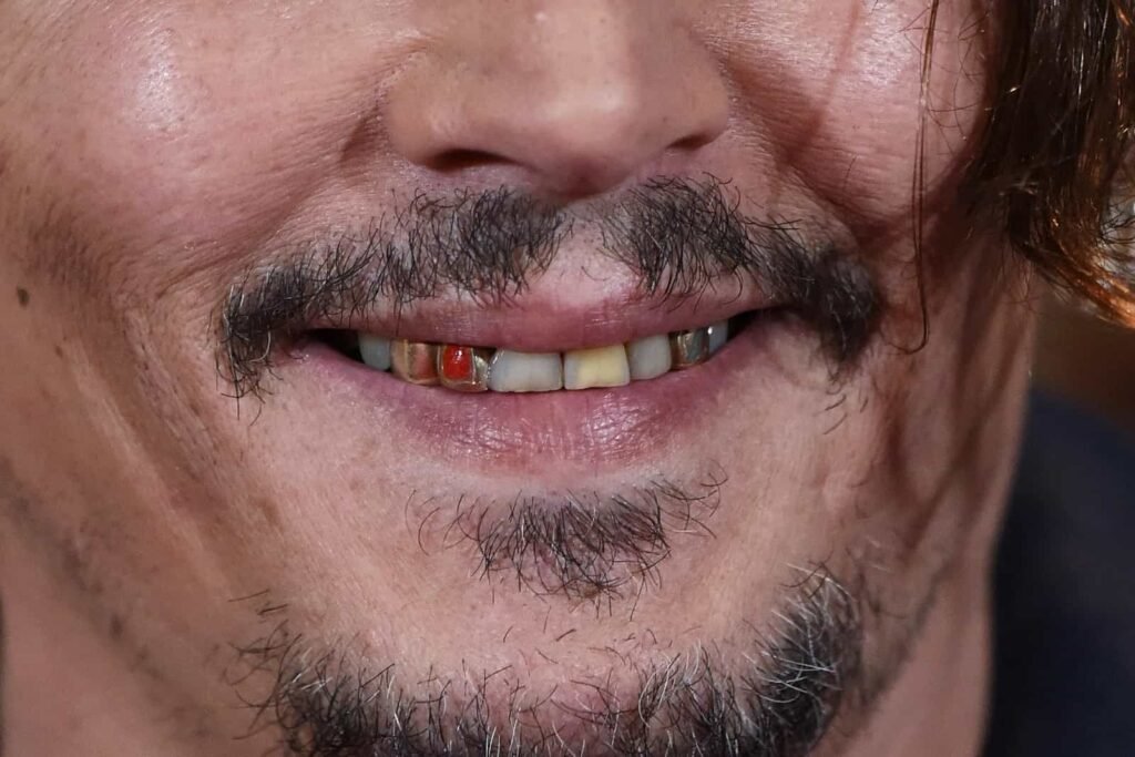 Johnny Depp Teeth Gold Capped Teeth (1)