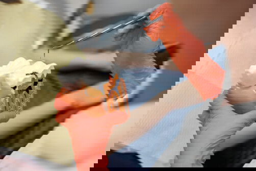 The Best Detailed Guide Root Canal Treatment (Endodontics)