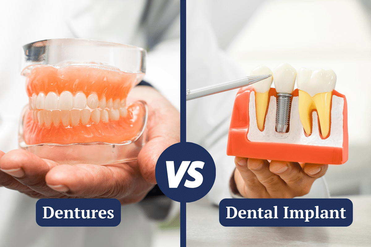 Dentures vs implants