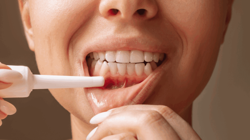 Periodontitis: Diagnosis, Stages, and Treatments
