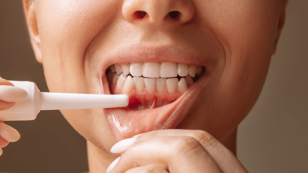 Periodontitis: Diagnosis, Stages, and Treatments