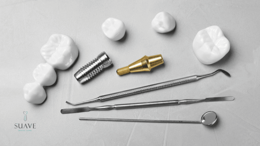 alternatives to dental implants from Suave Clinic