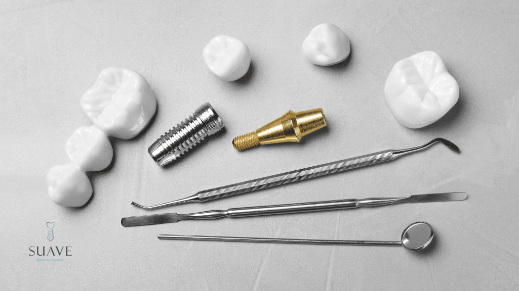 alternatives to dental implants from Suave Clinic