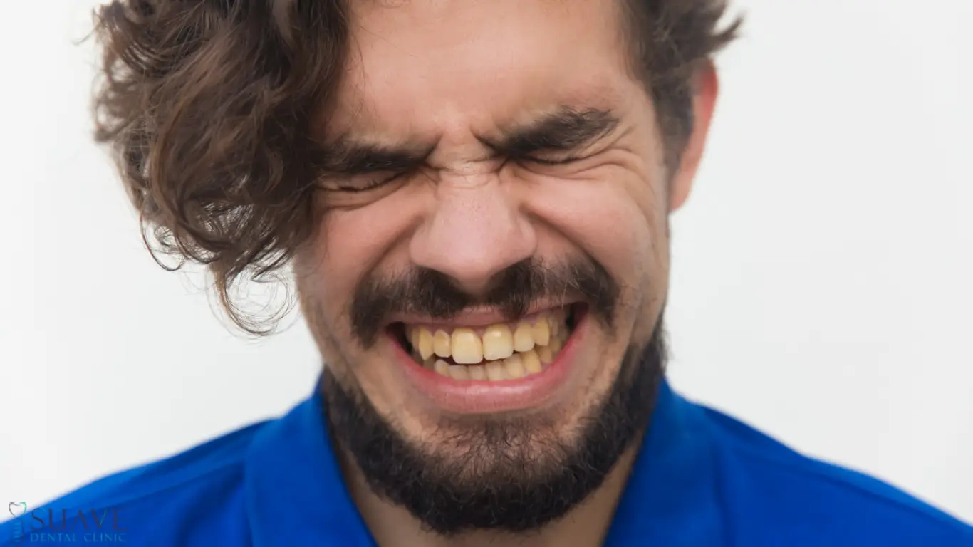 why are my teeth yellow when i brush them everyday- Suave Clinic