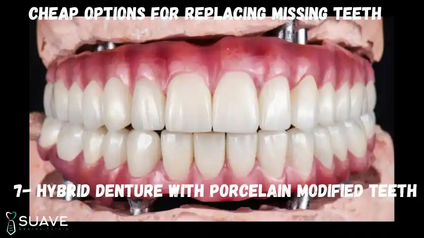 Cheap Options to Replace Missing Teeth 13 all on 4 hybrid denture with porcelain teeth