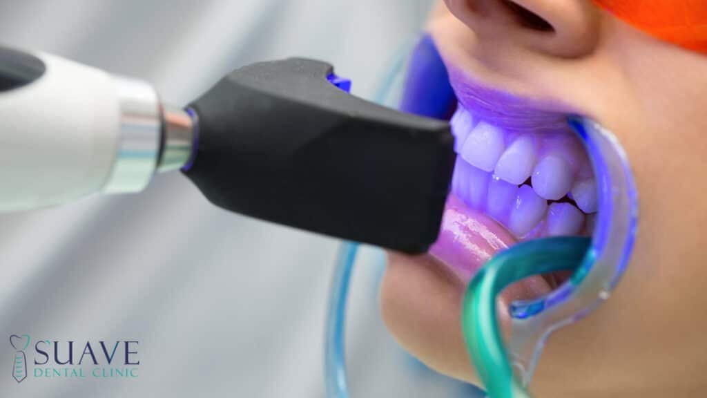 teeth whitening aftercare tips from Suave Clinic