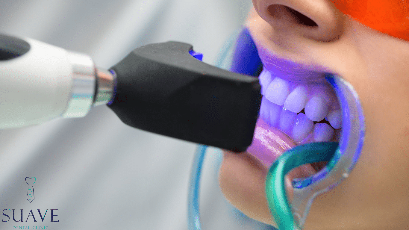 teeth whitening aftercare tips from Suave Clinic