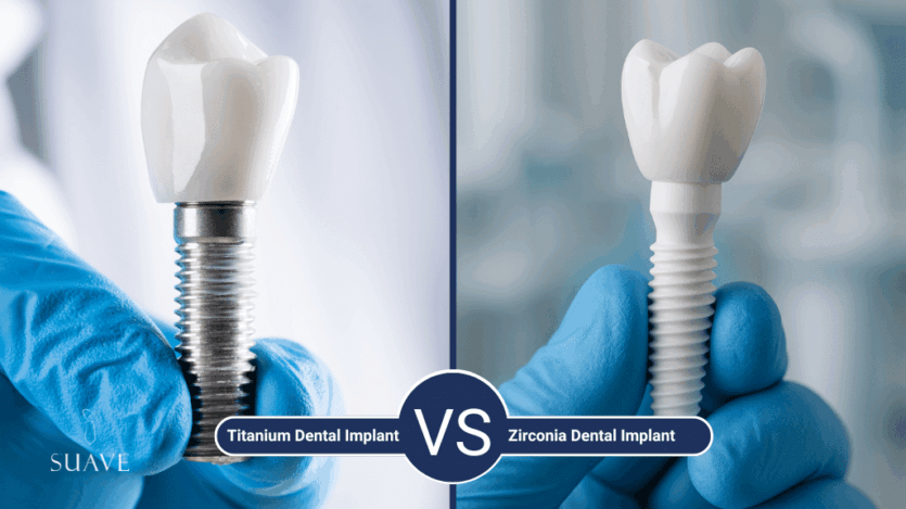 Zirconia dental implants vs titanium: Which one is the best for you?