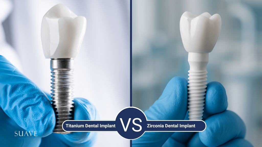 Zirconia dental implants vs titanium: Which one is the best for you?