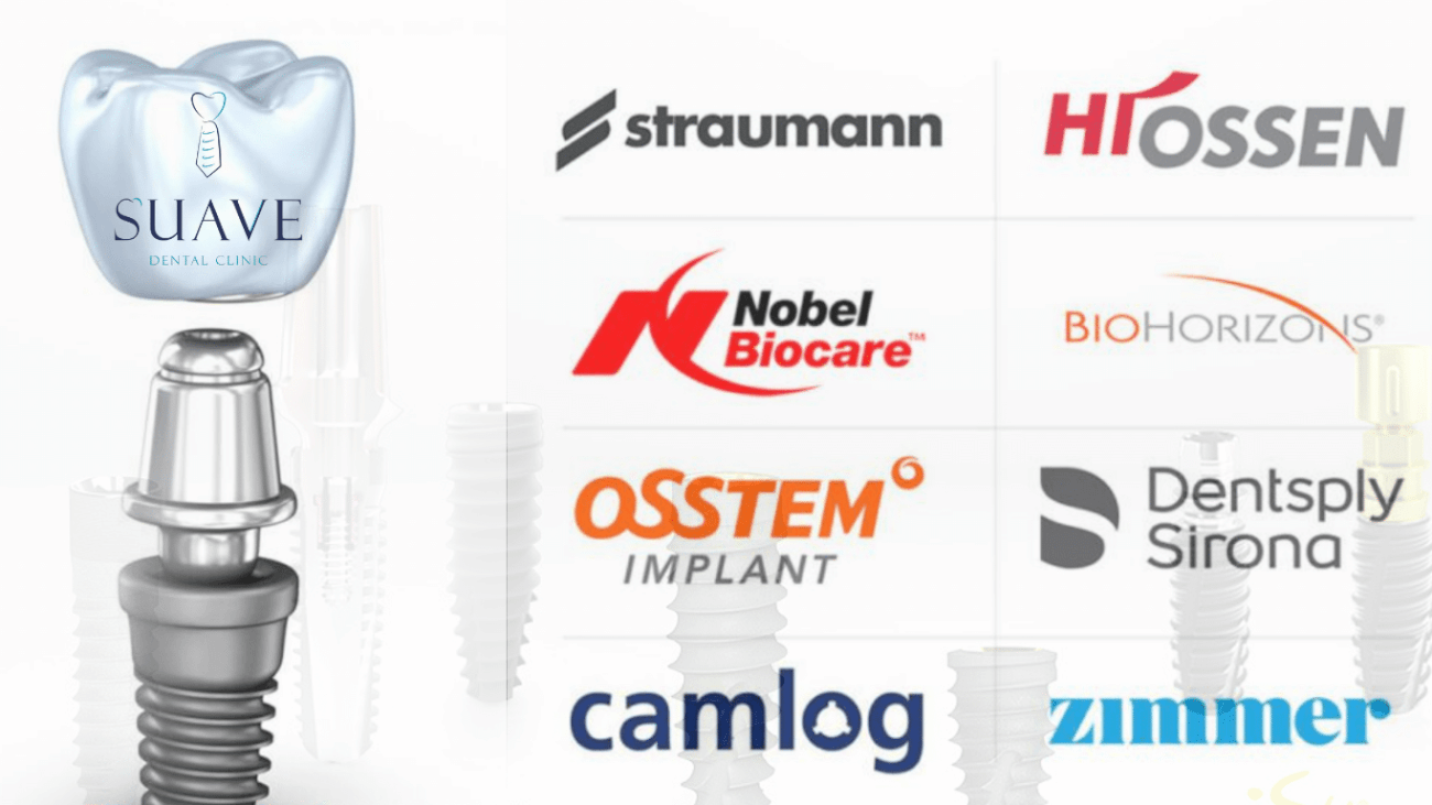 Top 10 Best Dental Implants You Can Get At Suave Clinic