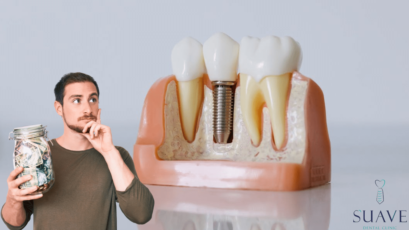 Cost of full mouth dental implants in Turkey
