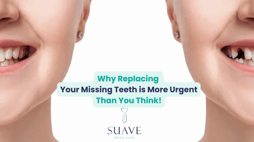 why replacing missing teeth with Suave clinic