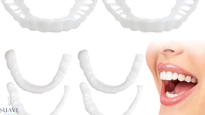 snap-on veneers in online stocks failure