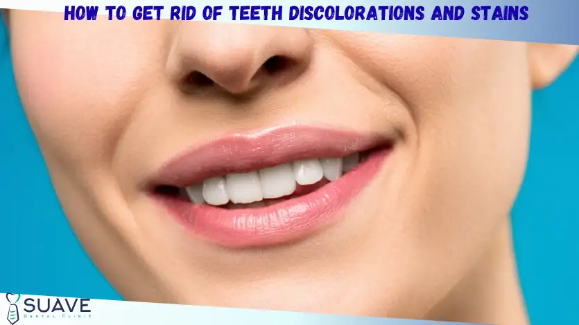 Home 7 how to remove teeth discolorations and stains