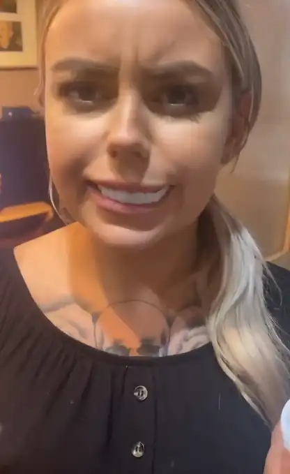 at-home clip-on veneers failure