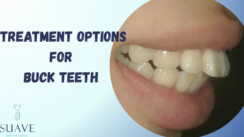treatment options to correct buck teeth with Suave Clinic