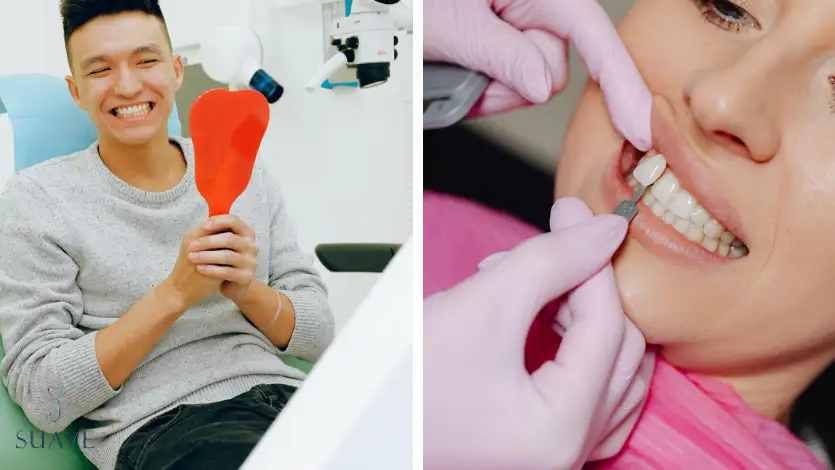 get perfect teeth and perfect smile with Suave Clinic