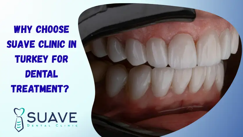 Turkey Teeth 6 why you choose suave clinic for turkey teeth