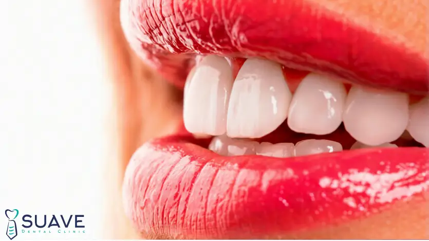 zirconia veneers for premium whiter smile