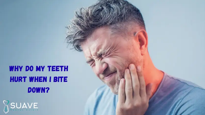 Why do my teeth hurt when I bite down? 5 why do my teeth hurt when I bite down, tooth pain on biting