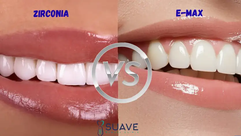 zirconia vs. Emax, best crowns for teeth, Suave clinic