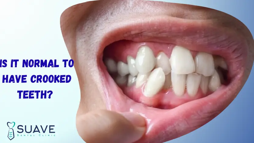 crooked teeth treatment at Suave clinic