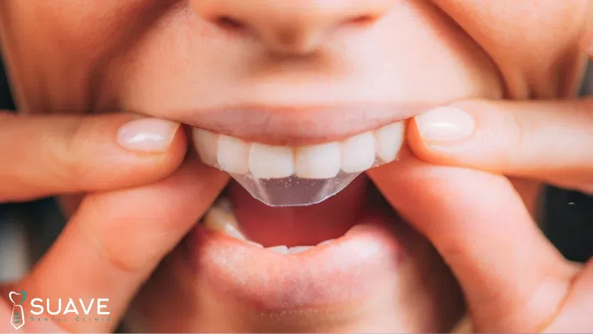 best teeth whitening strips and how to use them