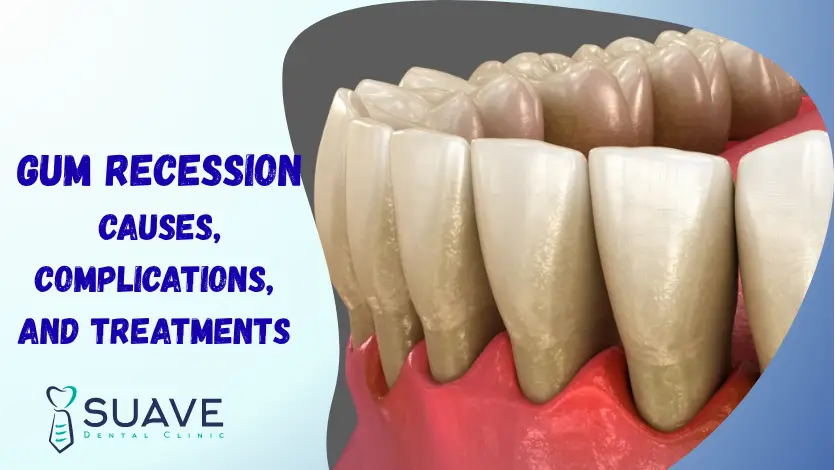 Home 5 treatment of receding gums and gum recession
