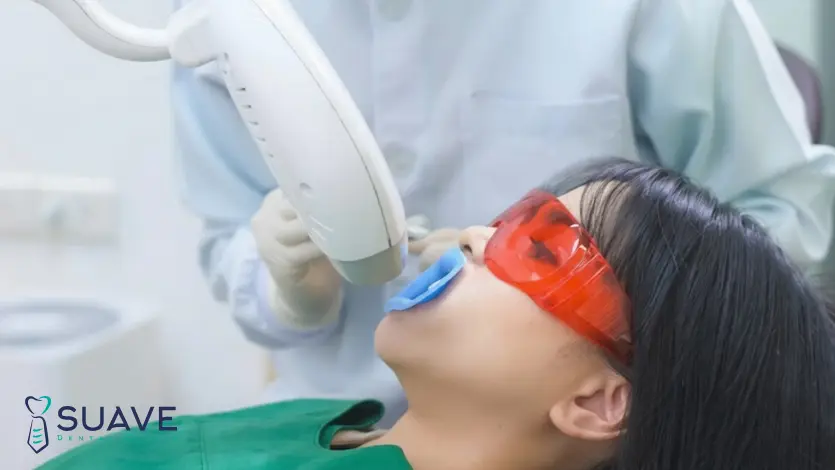 Home 5 internal bleaching for root canal teeth - Suave Clinic