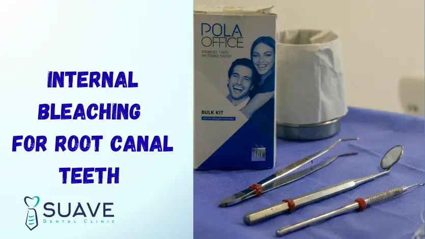 Internal Bleaching 7 internal teeth bleaching for black dead teeth