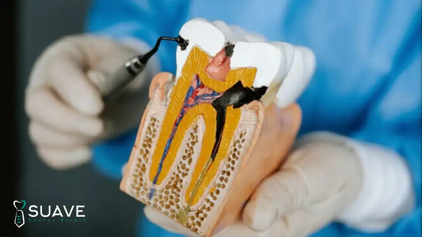 root canal treatment side effects and complications