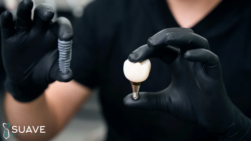 screwless dental implants at Suave Clinic