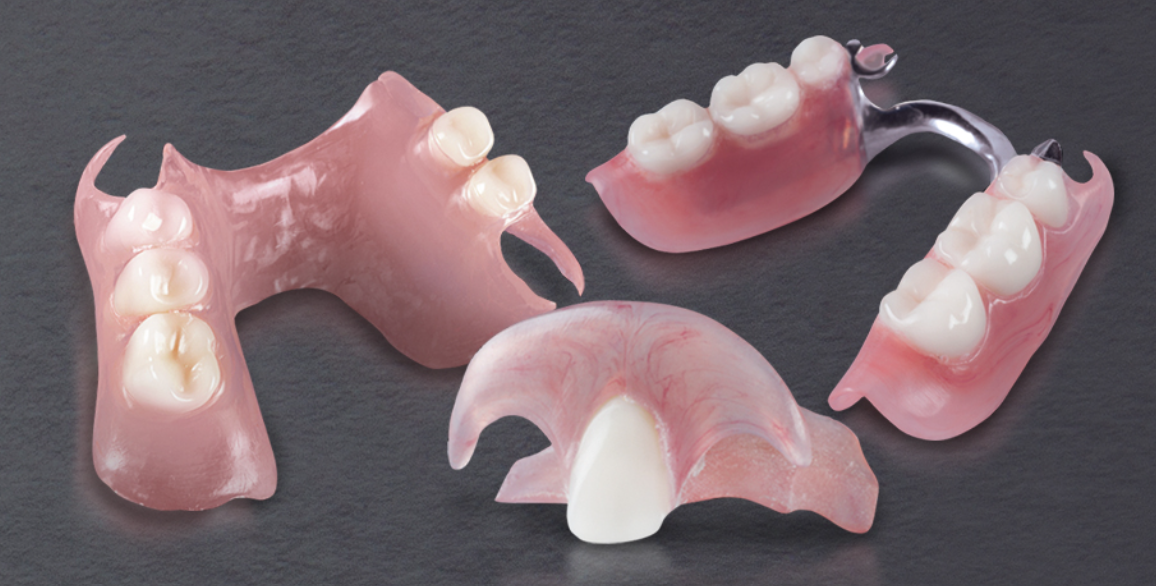 tissue and teeth supported dentures , partial denture