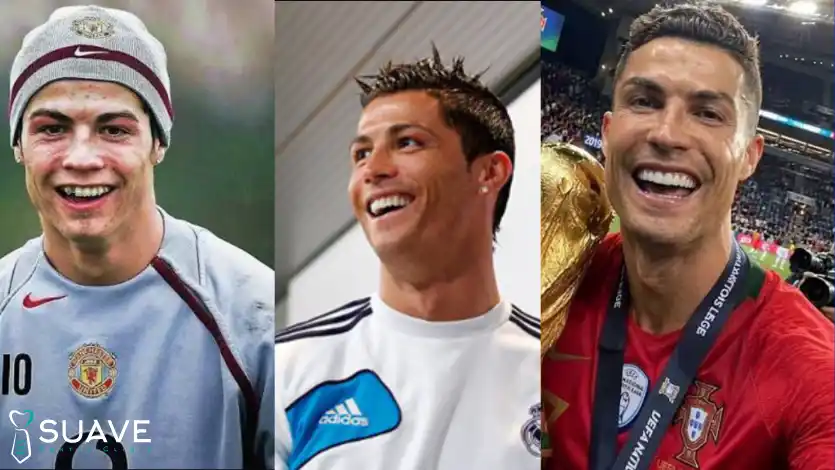 Home 5 cristiano ronaldo teeth before and after