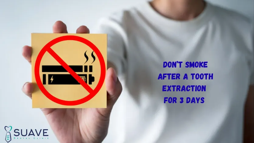 Home 5 Smoking after a tooth extraction is not allowed