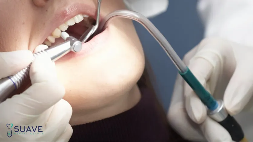how to remineralize teeth naturally and in-office